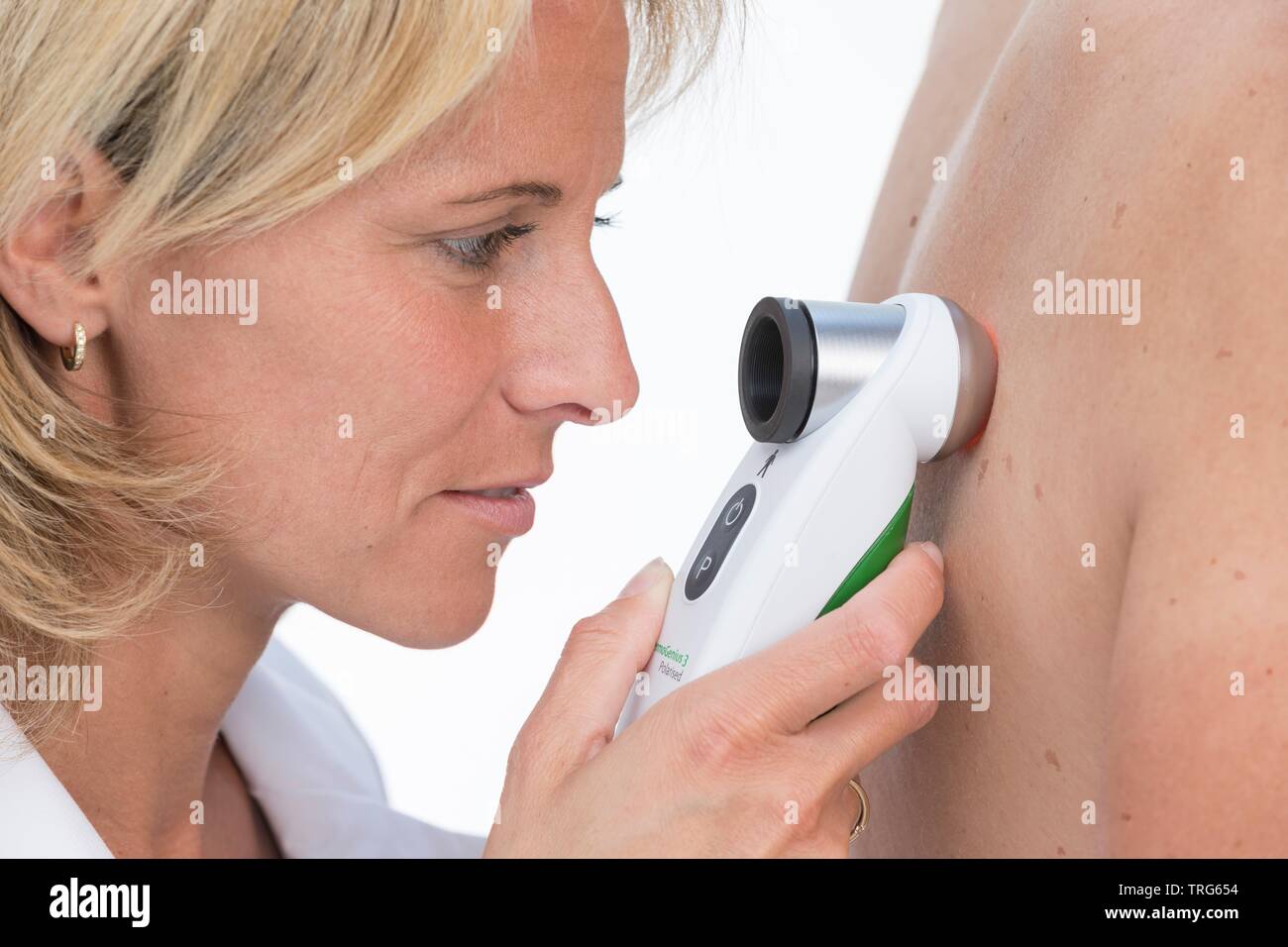 Il dermatologo femmina esaminando la pelle e birthmarks di un paziente di sesso maschile con un dermatoscope come parte di un skincancerscreening Foto Stock