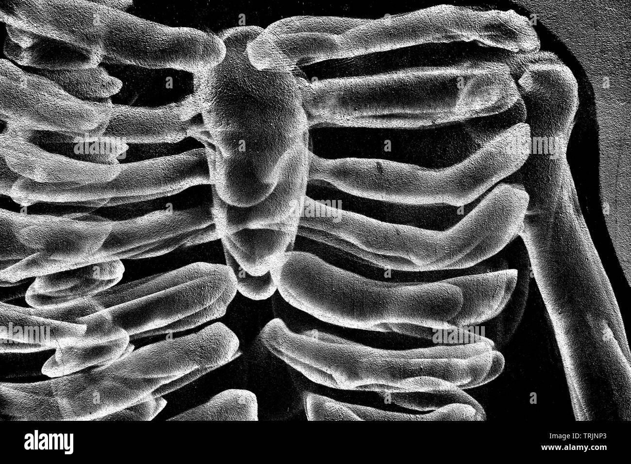 Lo scheletro di muro di vernice X-Ray spallamento Foto Stock