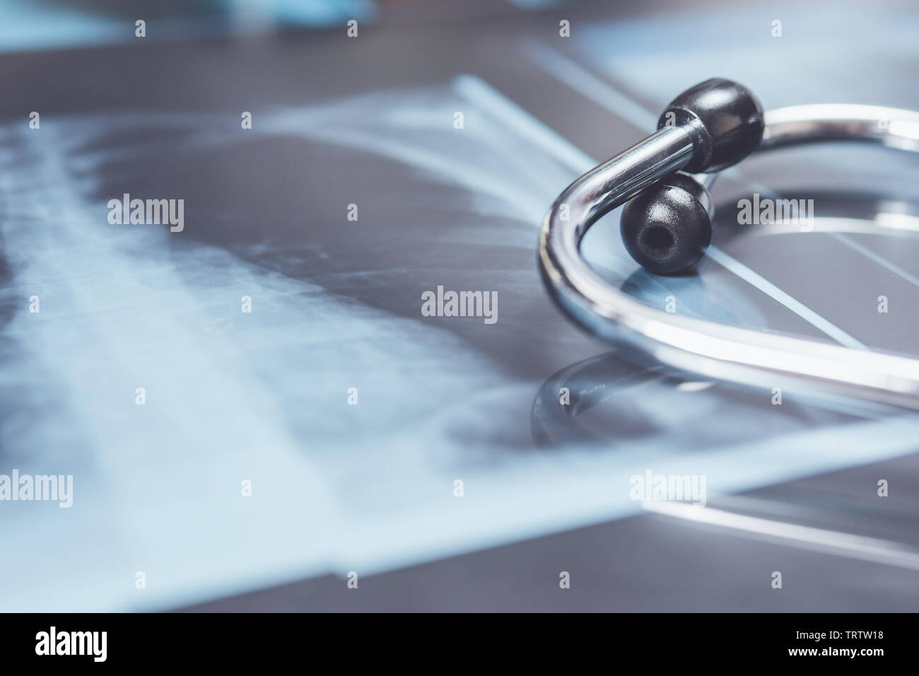 X-ray dei polmoni con stetoscopio. concetto malattia polmonare. Foto Stock