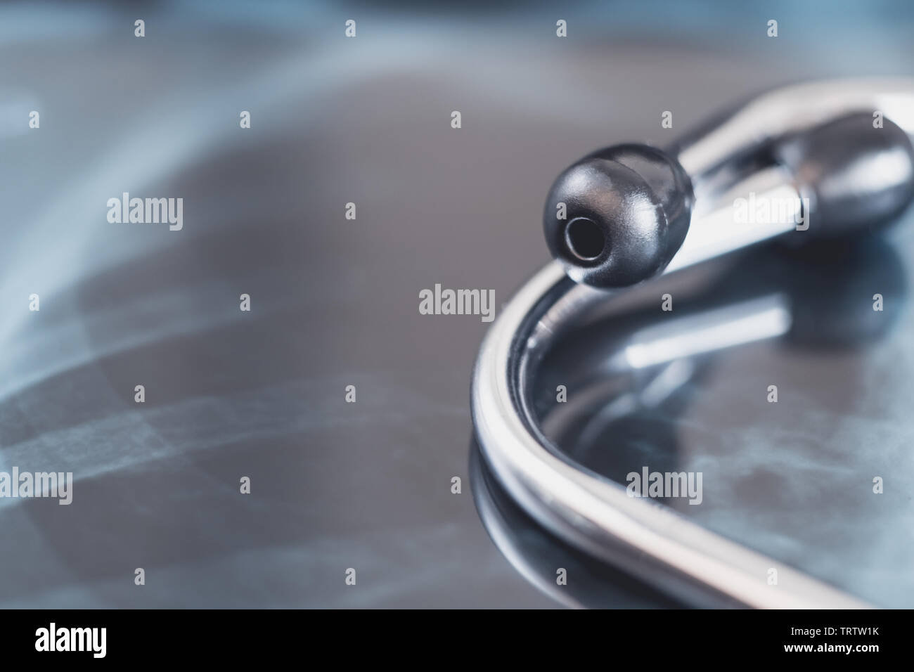 X-ray dei polmoni con stetoscopio. concetto malattia polmonare. Foto Stock