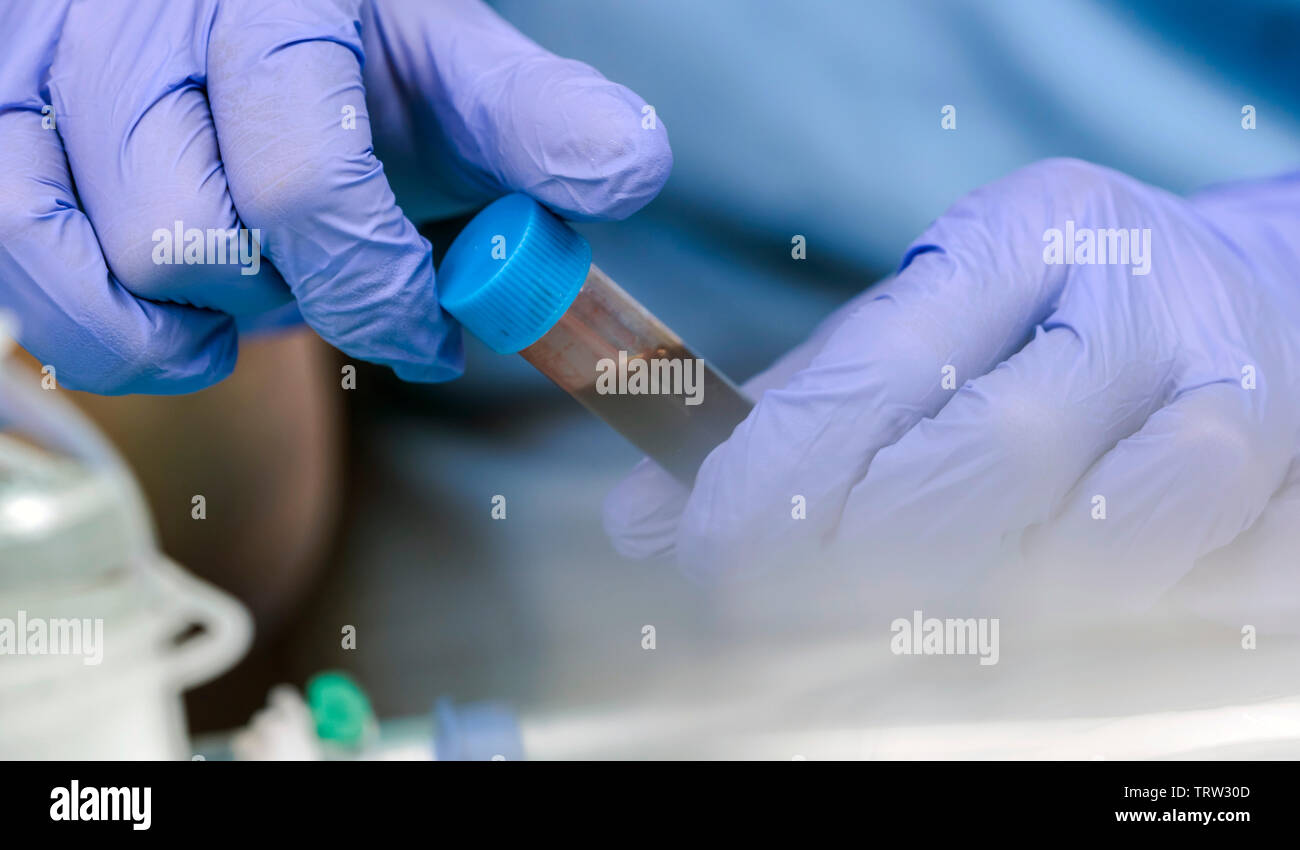 Un infermiere prende il campione di sangue in ospedale, immagine concettuale Foto Stock
