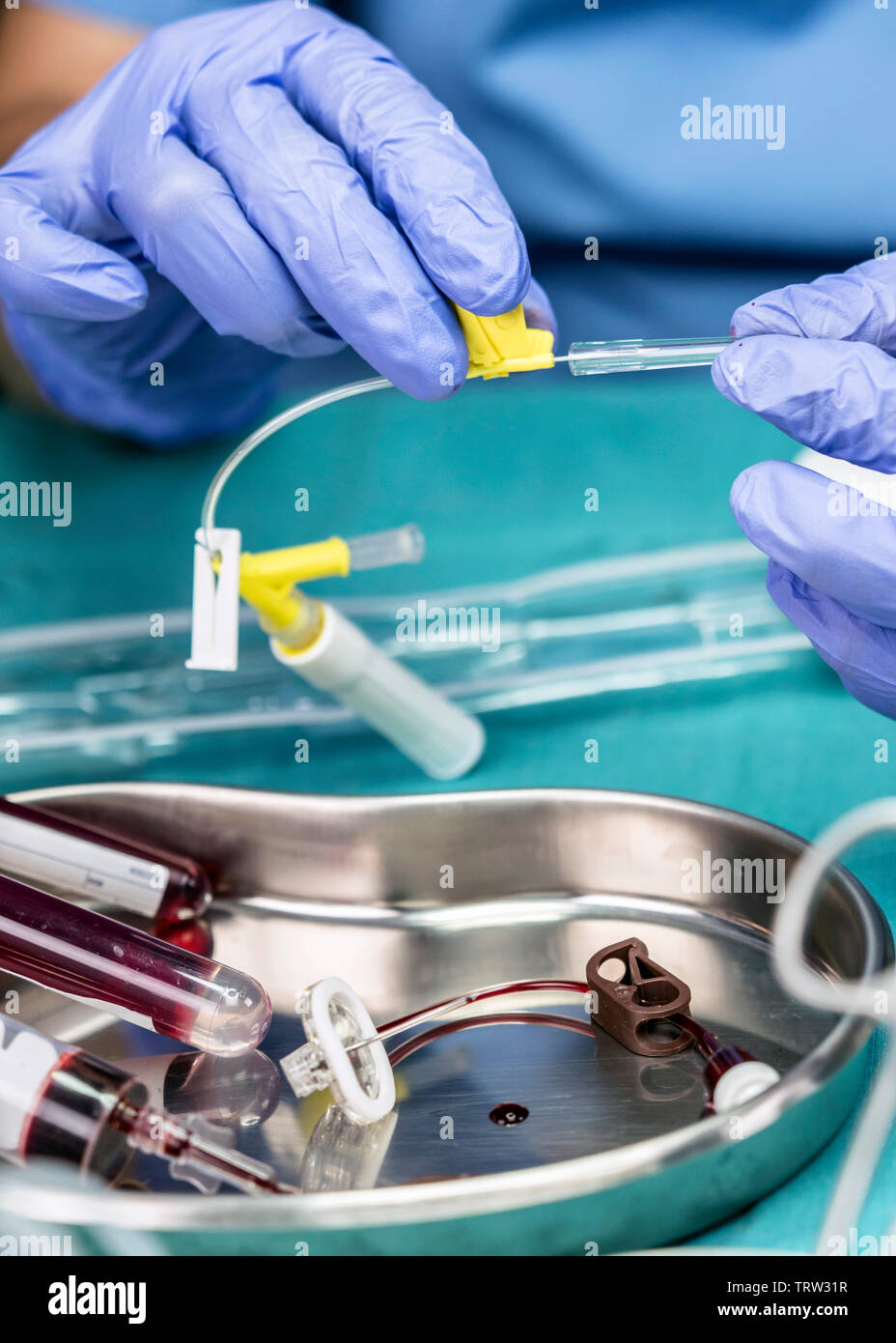 Infermiere prepara i cateteri venosi di lunga durata in un ospedale, accesso inabitazione linee venose centrali, immagine concettuale Foto Stock