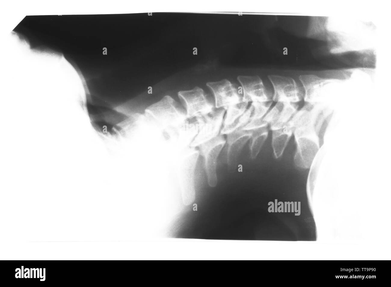 X-ray della colonna vertebrale umana isolata su bianco Foto Stock