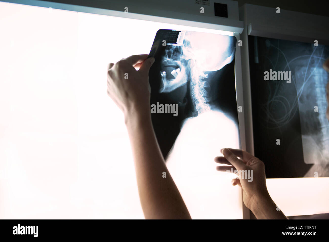 Immagine ritagliata della donna esame collo x-ray su diagnostica strumento medicale Foto Stock