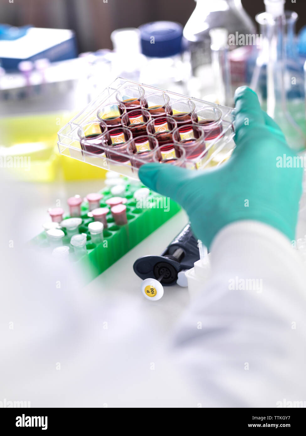 Ritagliate la mano dello scienziato azienda vassoio multipozzetto contenente cellule staminali durante la ricerca sul cancro in laboratorio Foto Stock