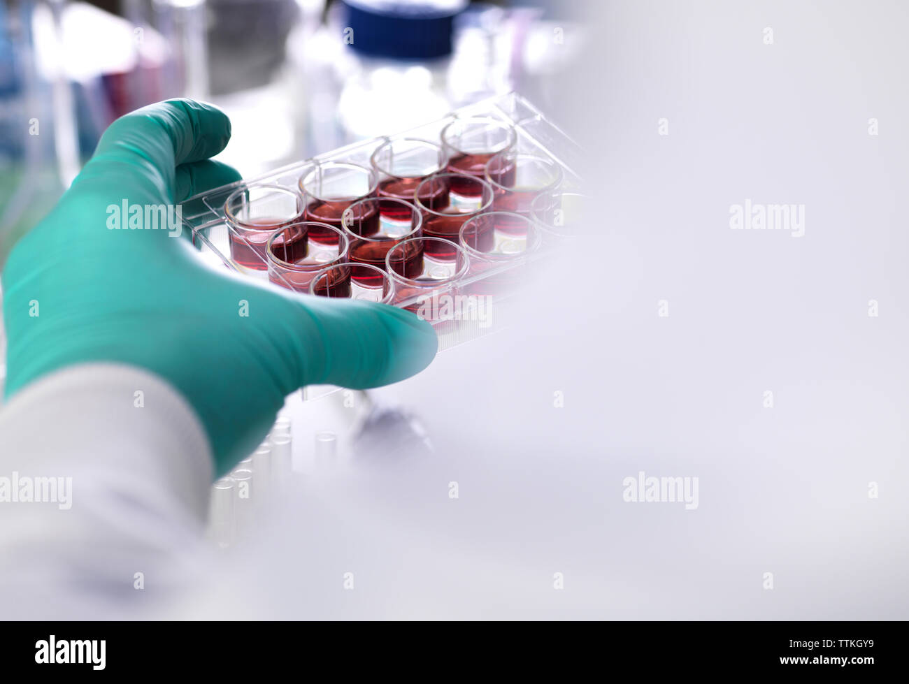 Ritagliate la mano dello scienziato indossando guanti di protezione tenendo il vassoio multipozzetto contenente cellule staminali durante la ricerca in laboratorio Foto Stock