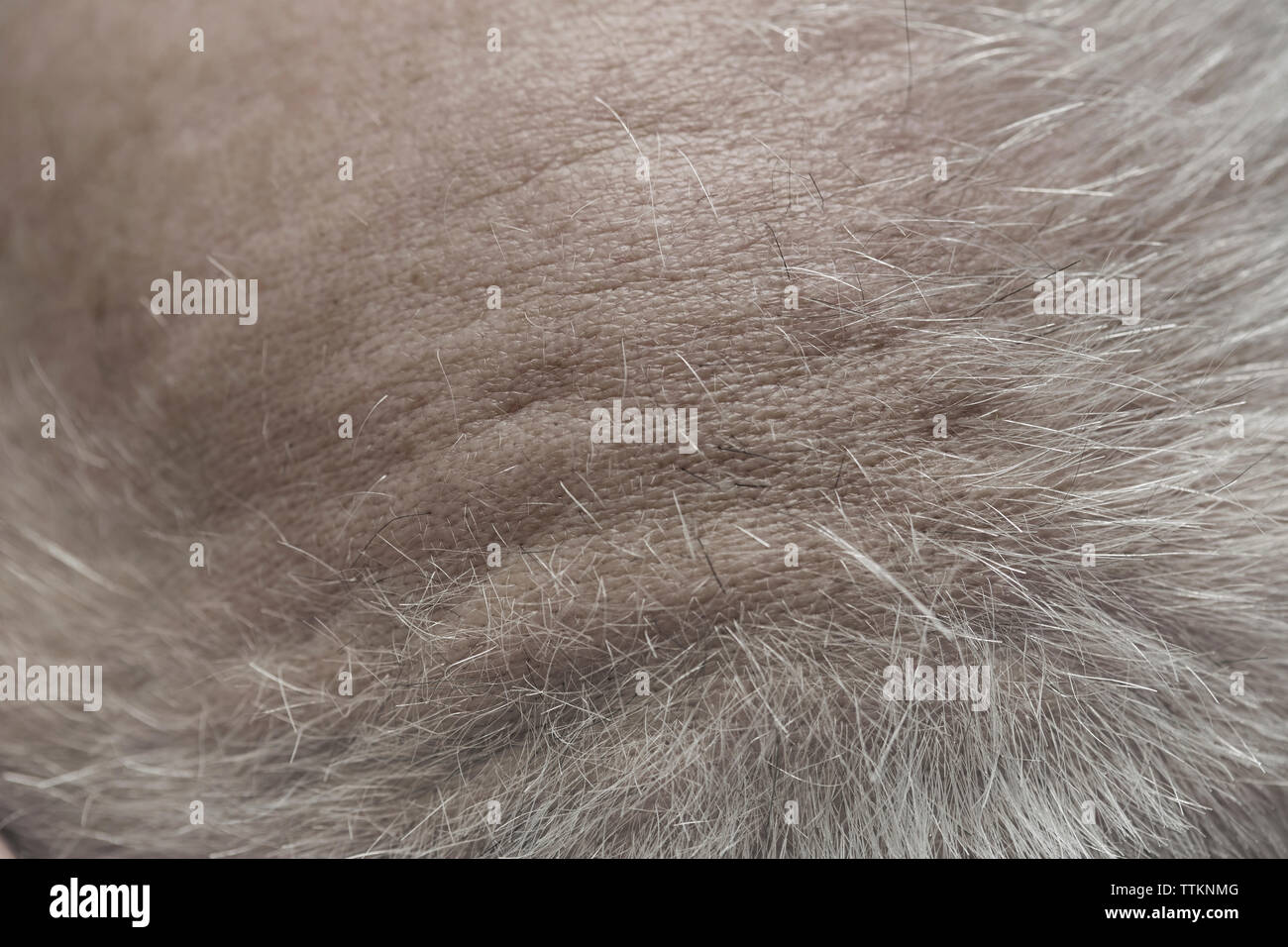 Vista aerea di uomo di cuoio capelluto Foto Stock