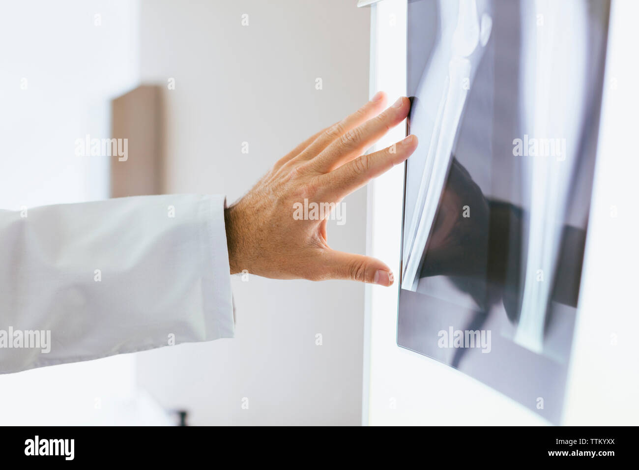 Close-up di medico toccando immagine a raggi x in clinica medica Foto Stock