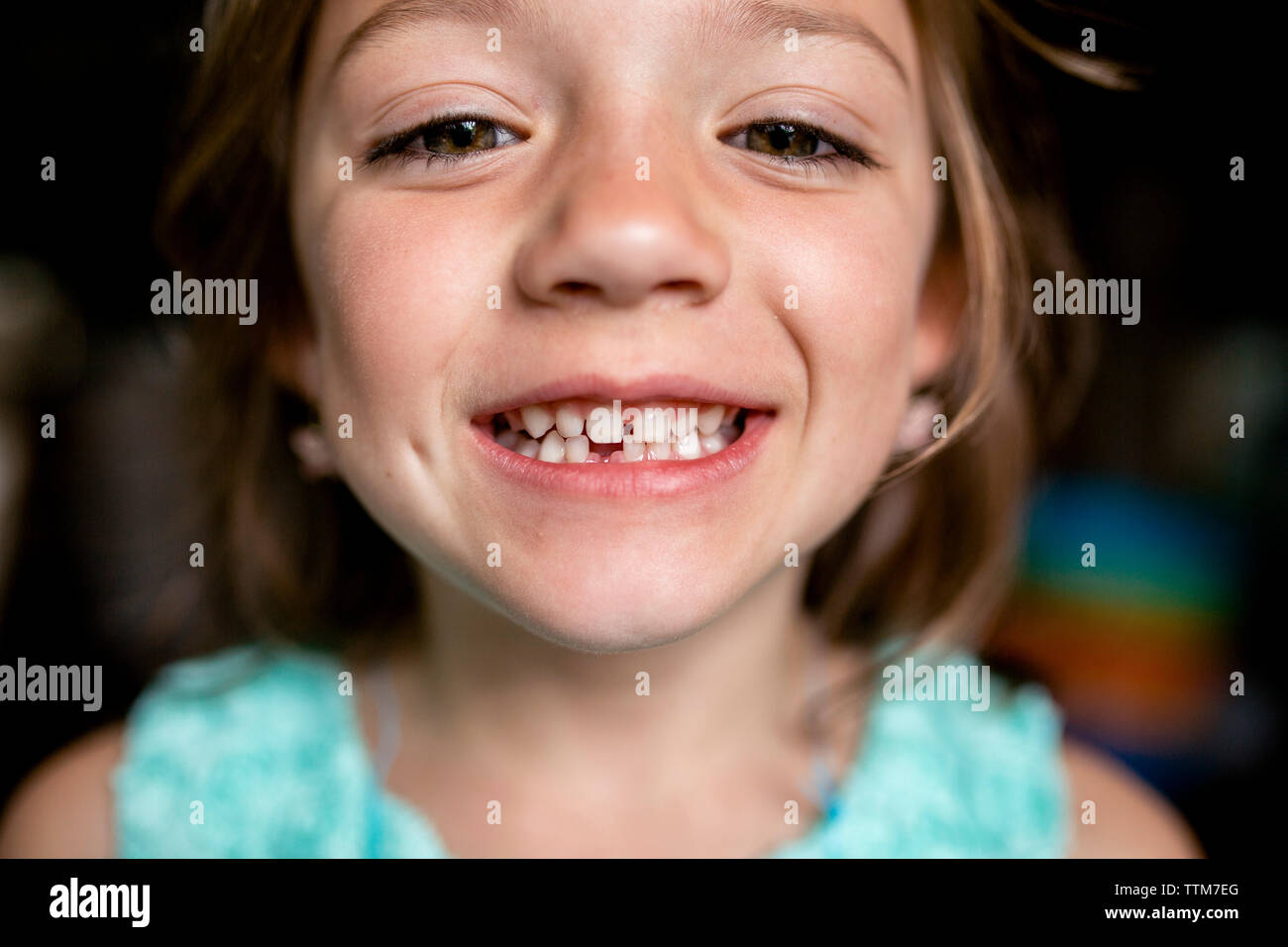 Close-up verticale di una ragazza che mostra il dente gap Foto Stock