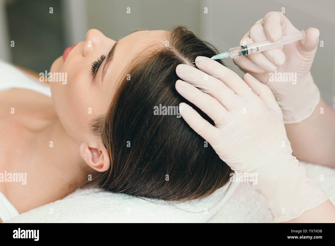Il trattamento della perdita di capelli, iniezione per la crescita dei capelli. Iniettato nella testa di donna, capelli mesoterapia Foto Stock