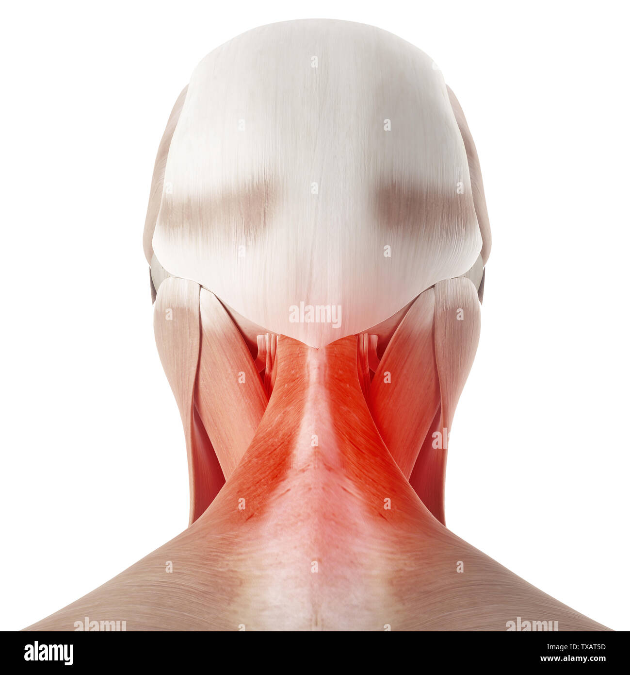 3D Rendering accurato dal punto di vista medico illustrazione di un doloroso collo Foto Stock