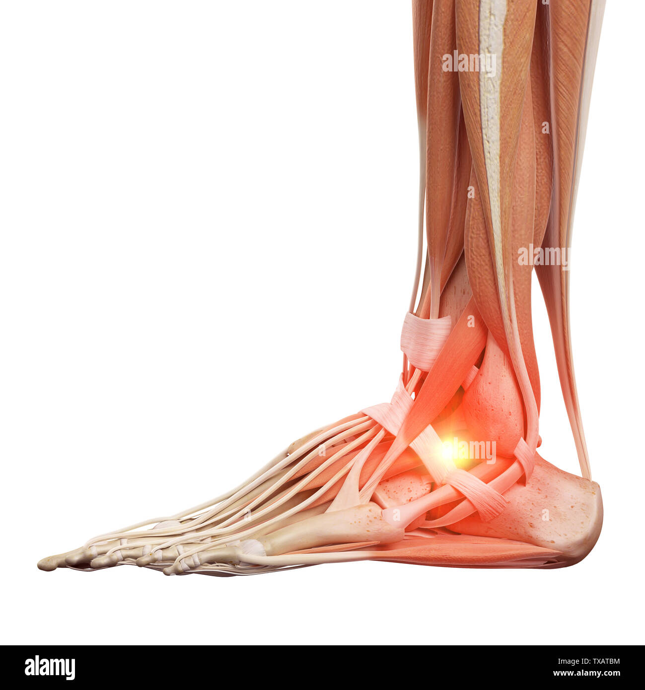 3D Rendering accurato dal punto di vista medico illustrazione di un doloroso caviglia Foto Stock