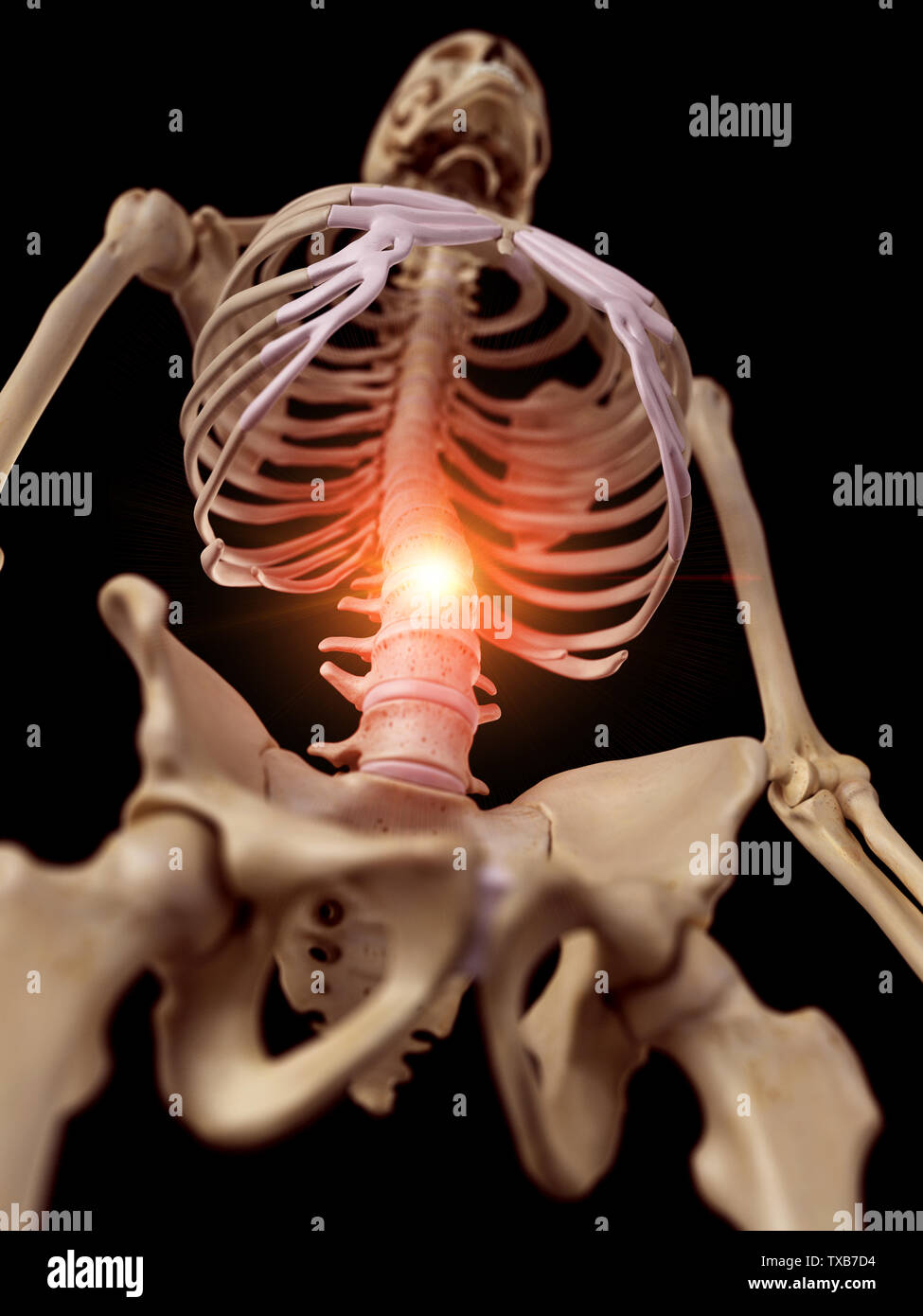 3D Rendering accurato dal punto di vista medico illustrazione di una spina dolorosa Foto Stock