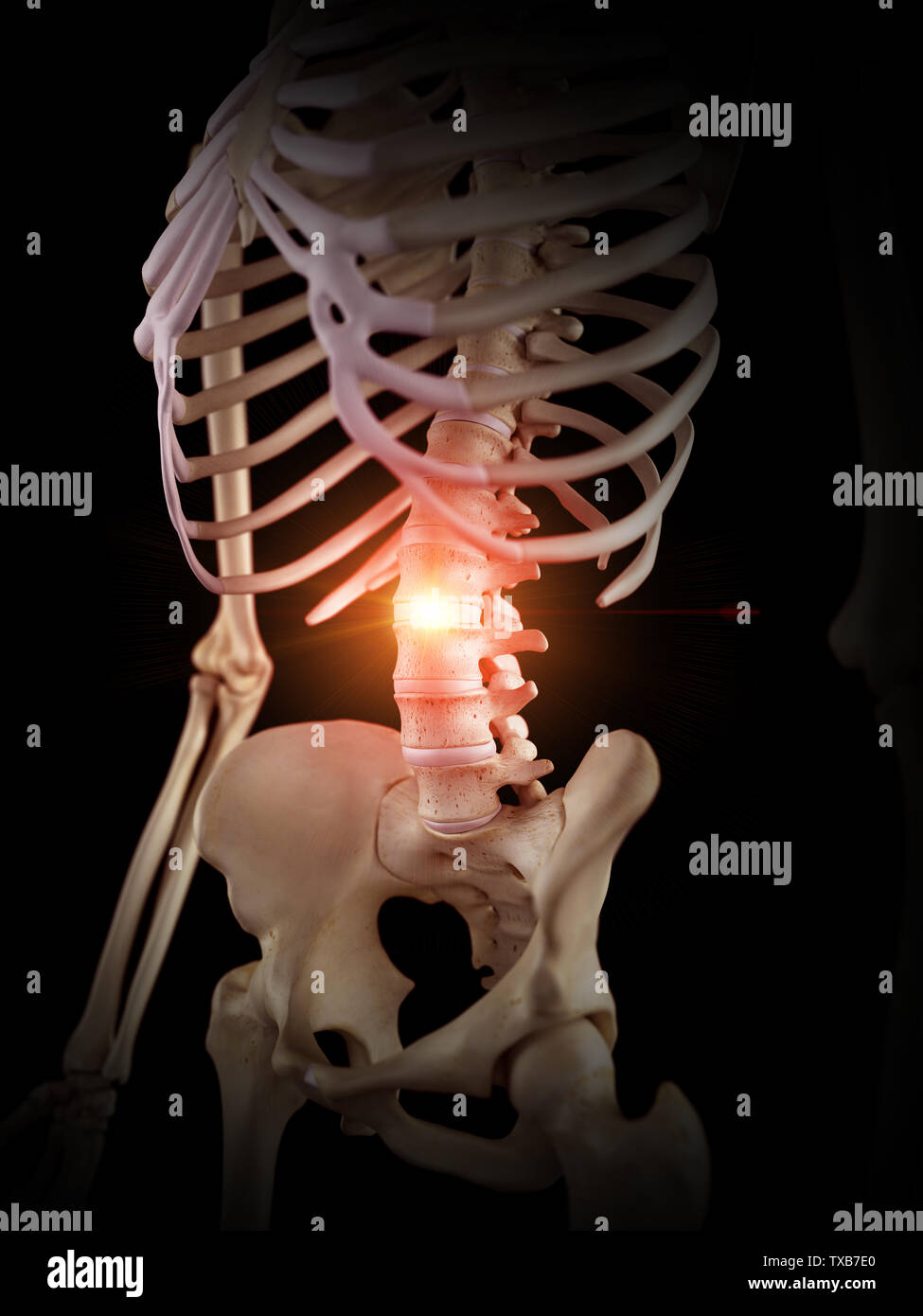 3D Rendering accurato dal punto di vista medico illustrazione di una spina dolorosa Foto Stock