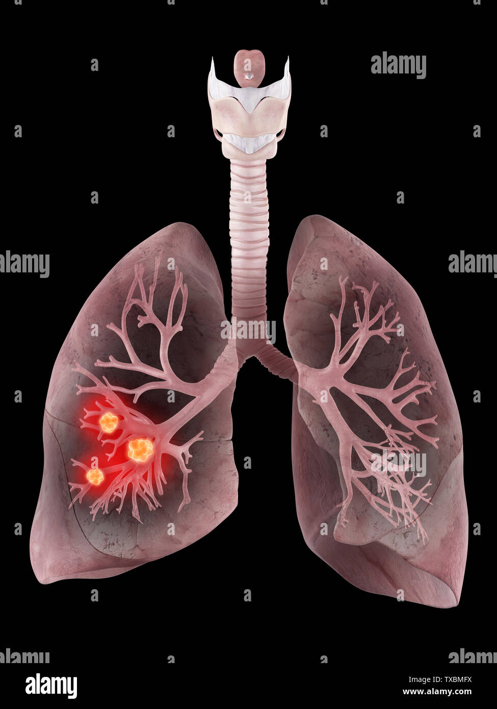 3D Rendering accurato dal punto di vista medico illustrazione del polmone umano e dei bronchi Foto Stock