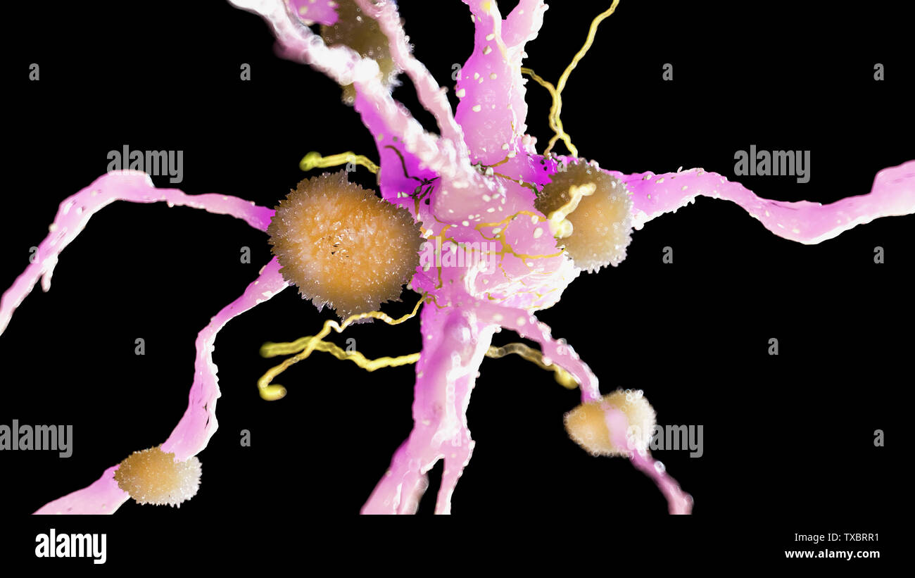 3D Rendering accurato dal punto di vista medico illustrazione delle placche amiloidi su un morbo di Alzheimer cellula nervosa Foto Stock