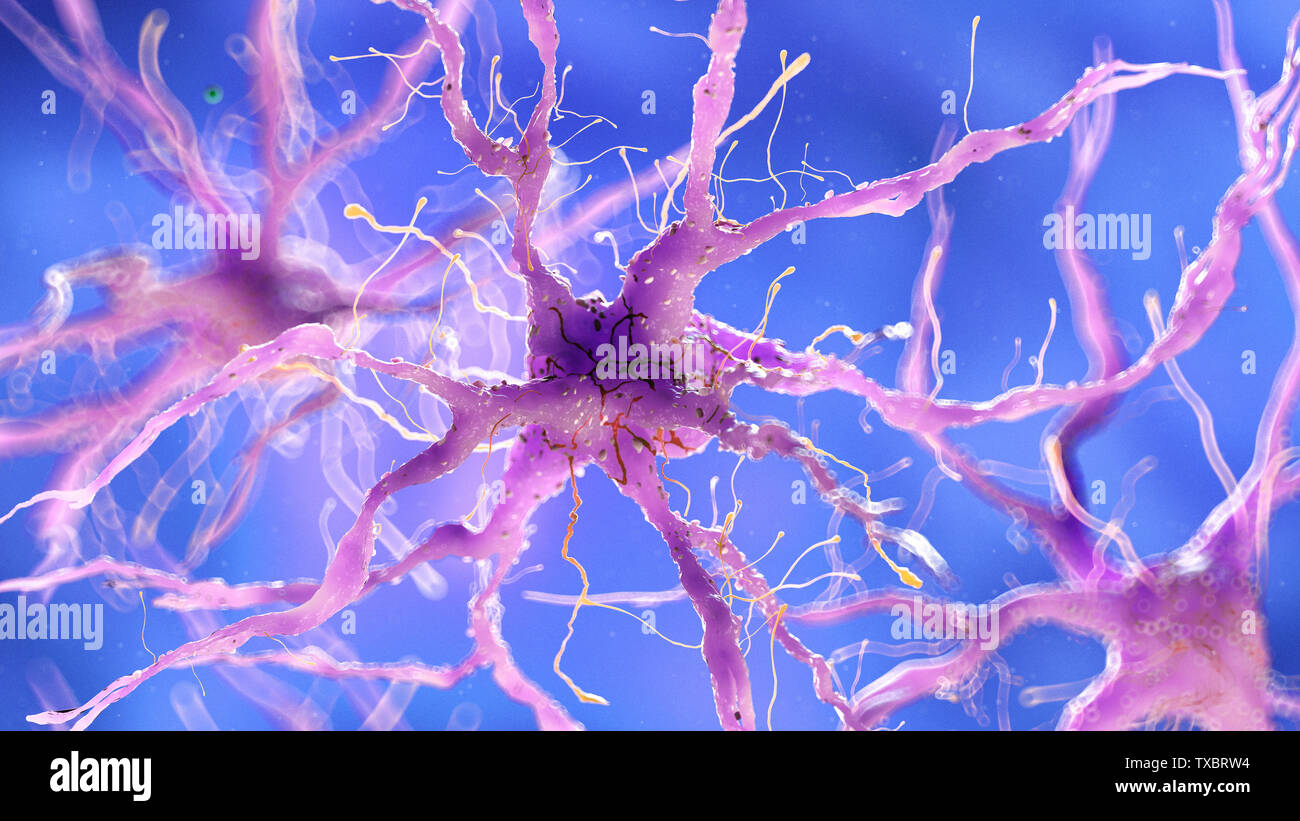 3D Rendering accurato dal punto di vista medico illustrazione del danneggiamento di una cellula nervosa Foto Stock