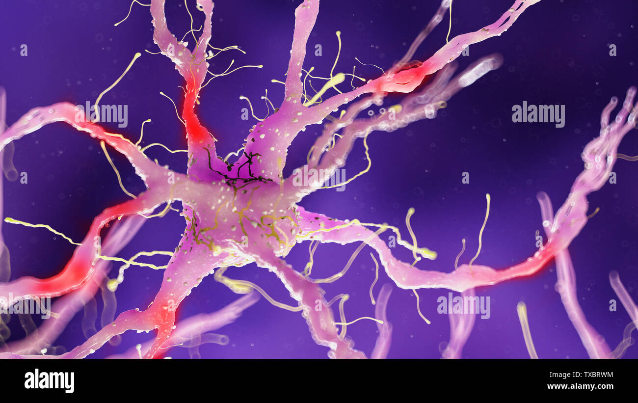 3D Rendering accurato dal punto di vista medico illustrazione del danneggiamento di una cellula nervosa Foto Stock