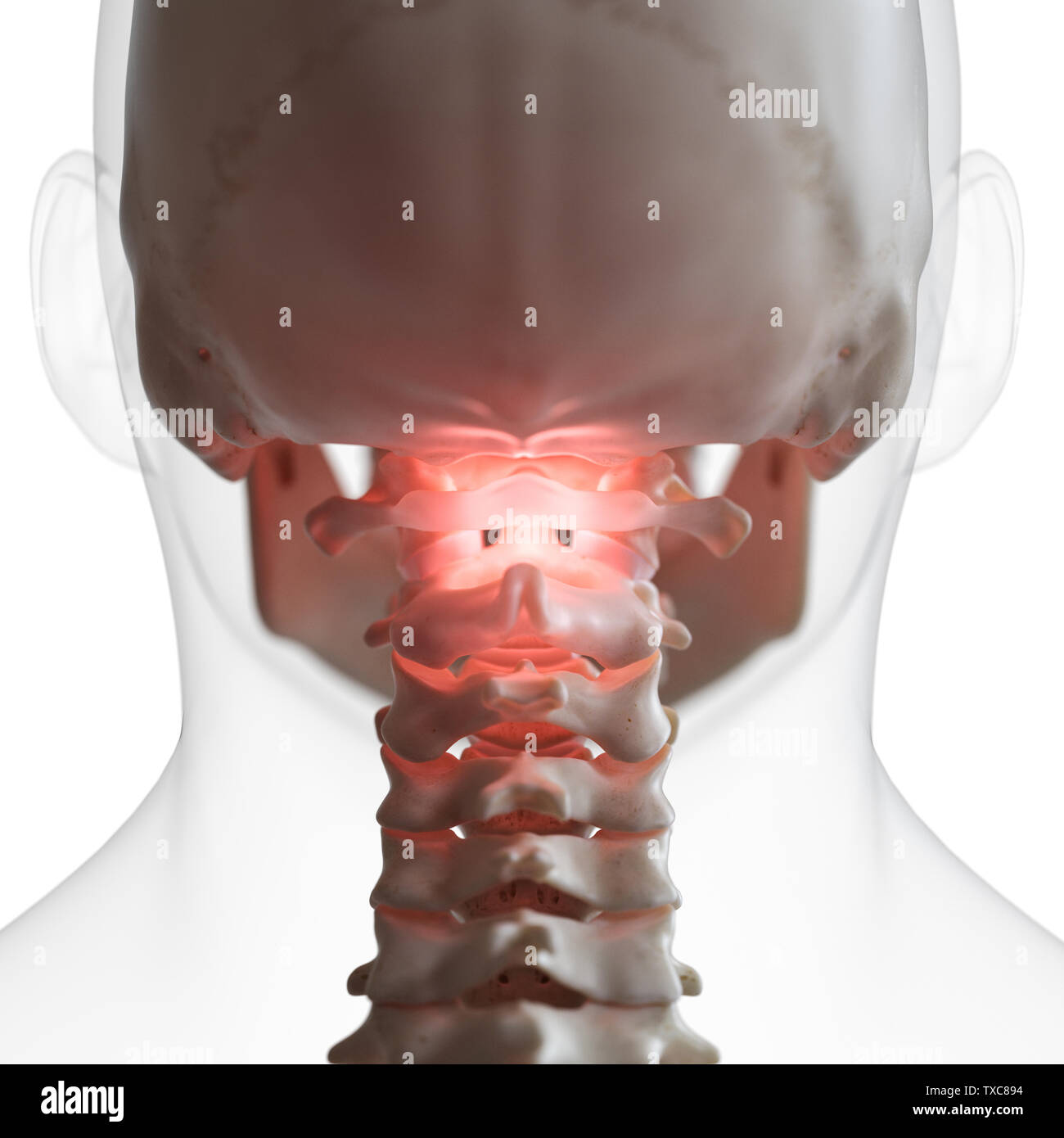 3D Rendering accurato dal punto di vista medico illustrazione di un doloroso atlas osso Foto Stock