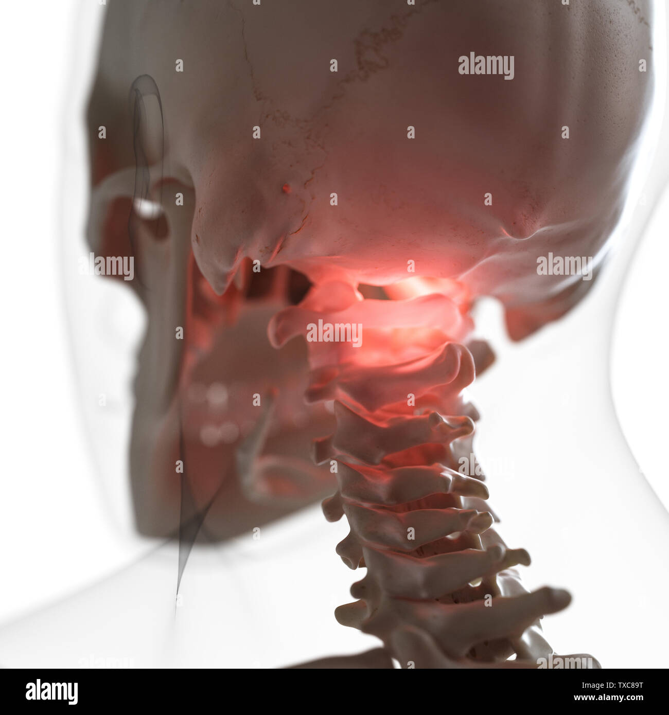 3D Rendering accurato dal punto di vista medico illustrazione di un doloroso atlas osso Foto Stock