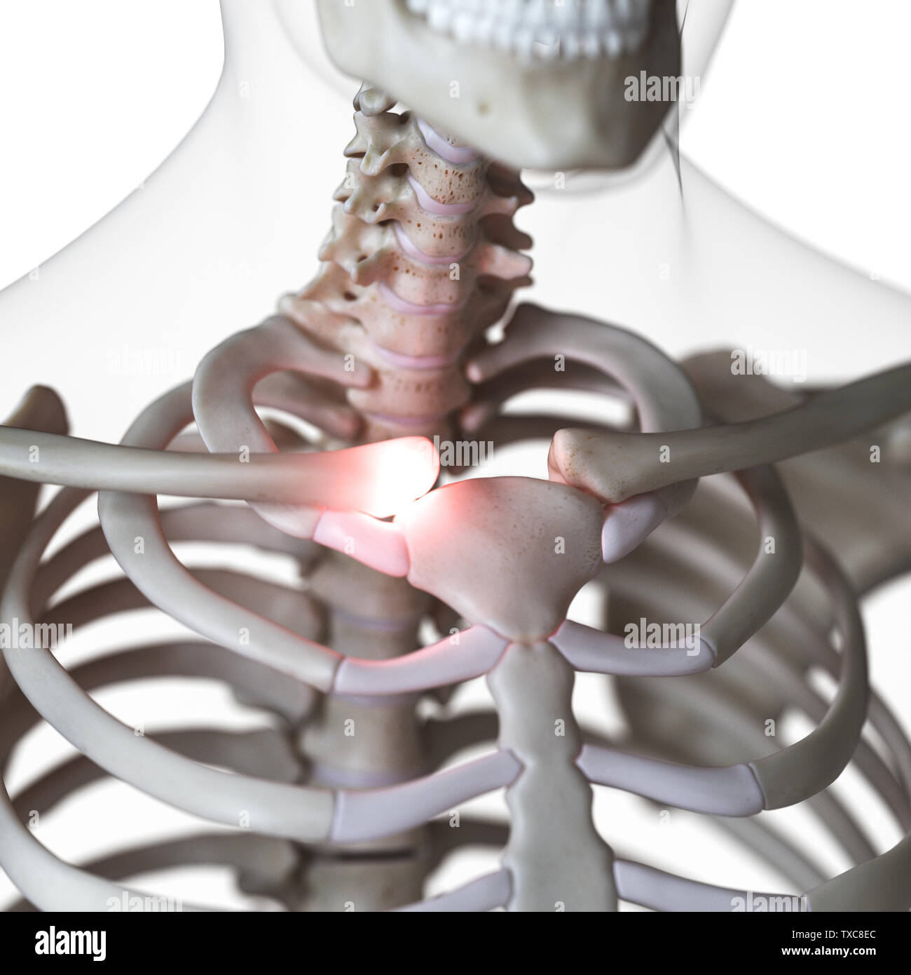 3D Rendering accurato dal punto di vista medico illustrazione di dolorosa sternoclavicular joint Foto Stock