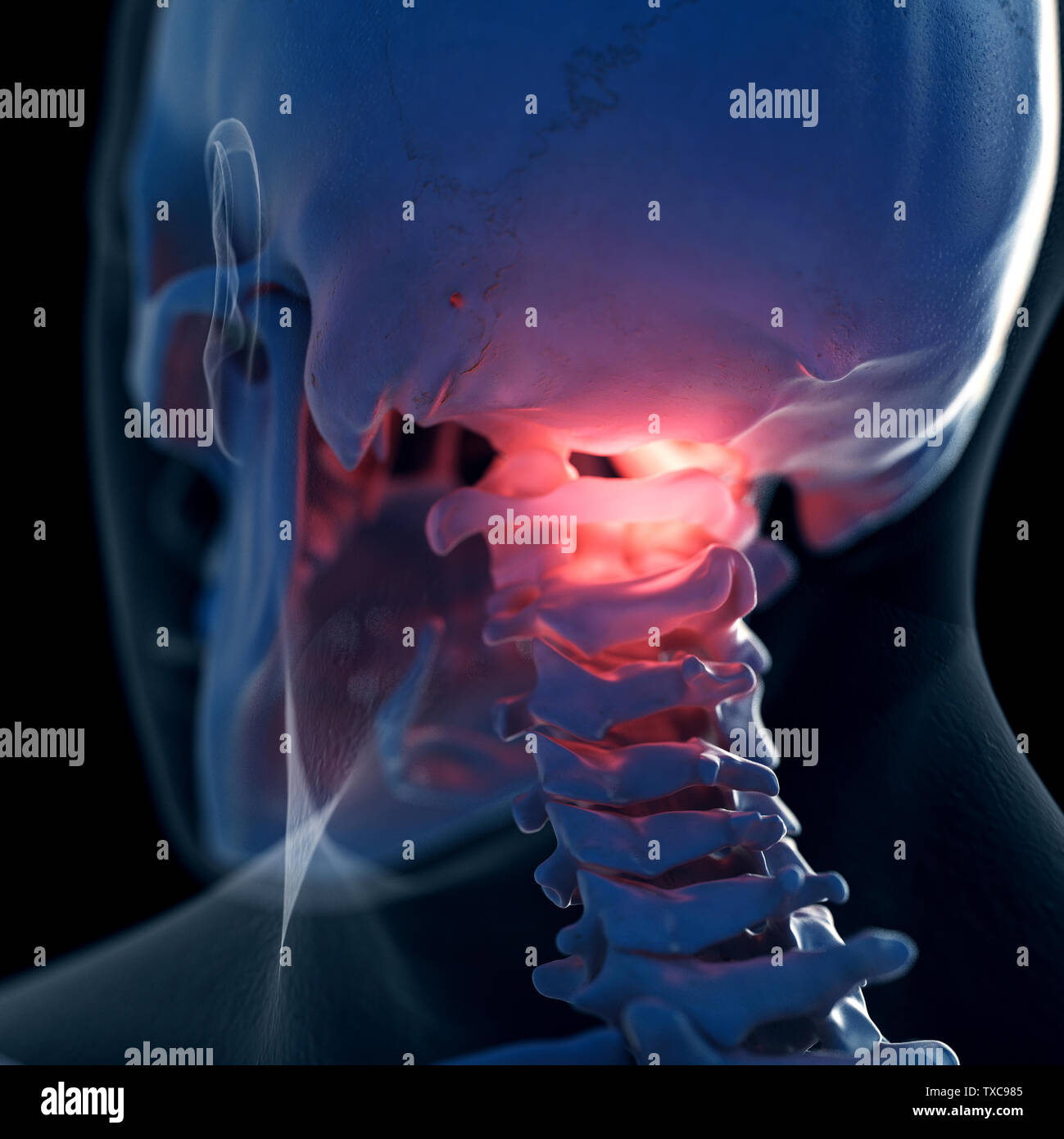 3D Rendering accurato dal punto di vista medico illustrazione di un doloroso atlas osso Foto Stock