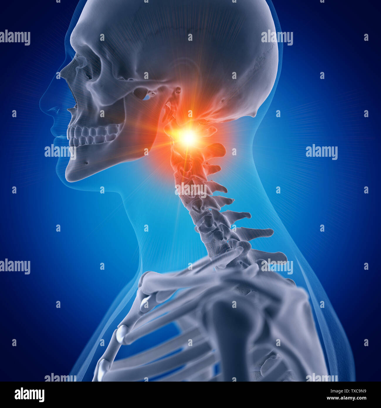 3D Rendering accurato dal punto di vista medico illustrazione della dolorosa osso atlas Foto Stock