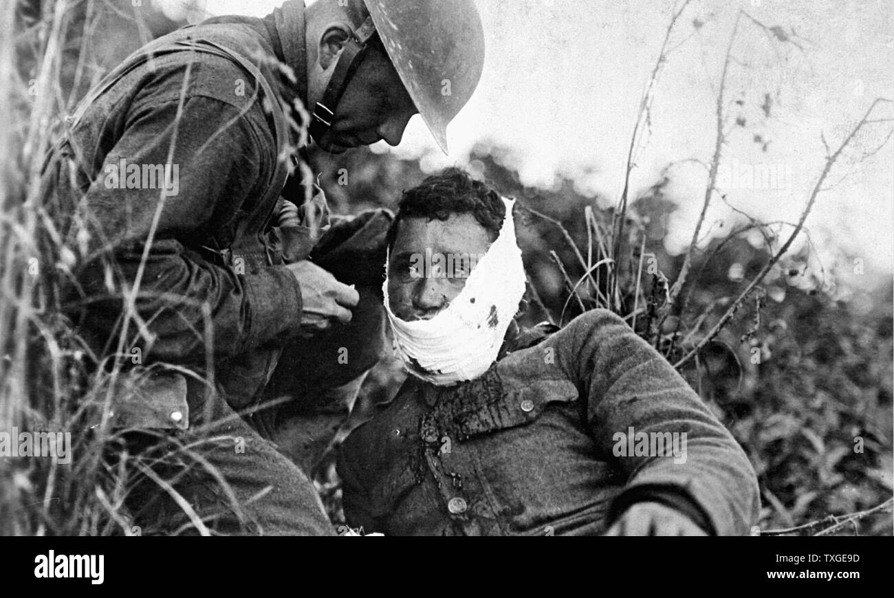 Fotografia di un ferito soldato americano, ricevendo cure di pronto soccorso durante la Prima Guerra Mondiale. Datata 1918 Foto Stock