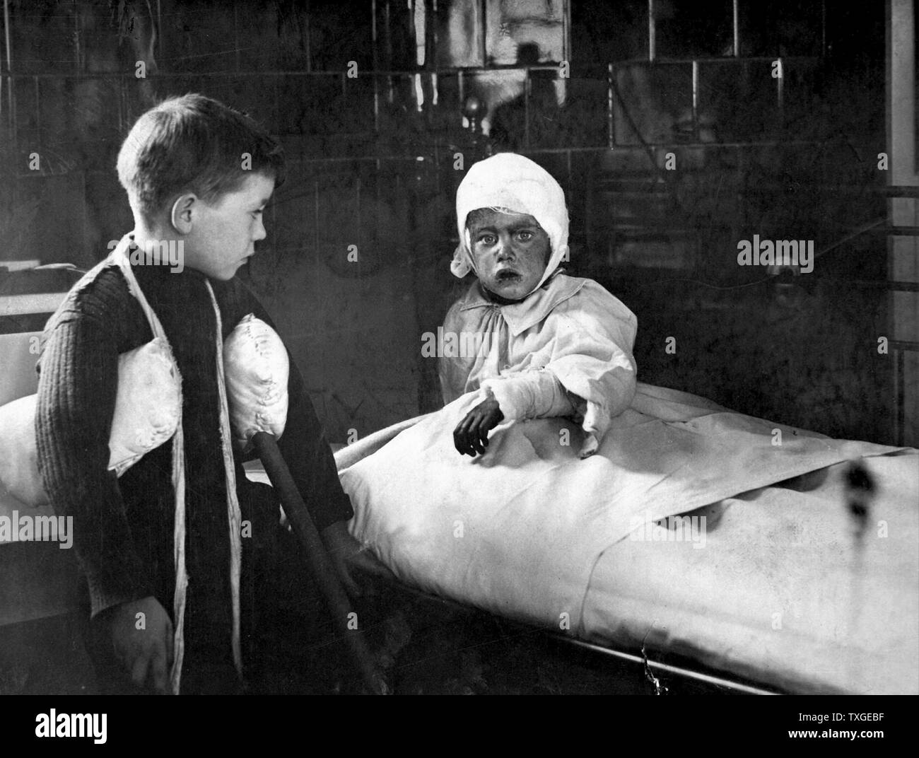 Fotografia di bambini feriti in ospedale dopo un raid aereo durante la Prima Guerra Mondiale. Datata 1915 Foto Stock