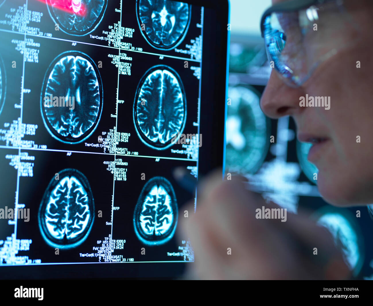 Medico visualizzazione delle scansioni cerebrali per possibili malattie o danni in clinica Foto Stock