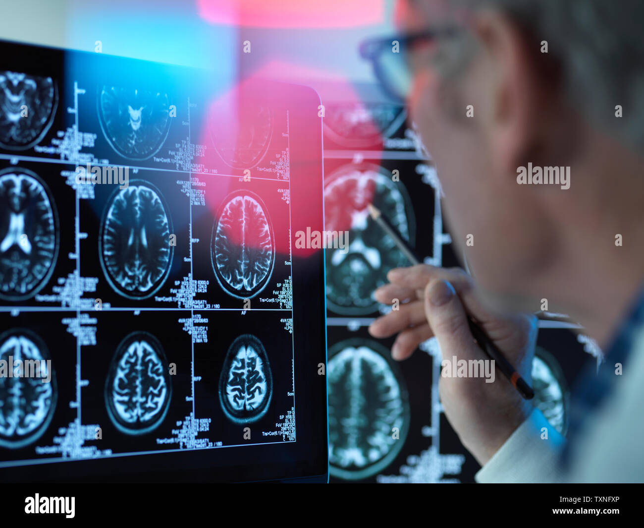 Medico visualizzazione delle scansioni cerebrali per possibili malattie o danni in clinica Foto Stock