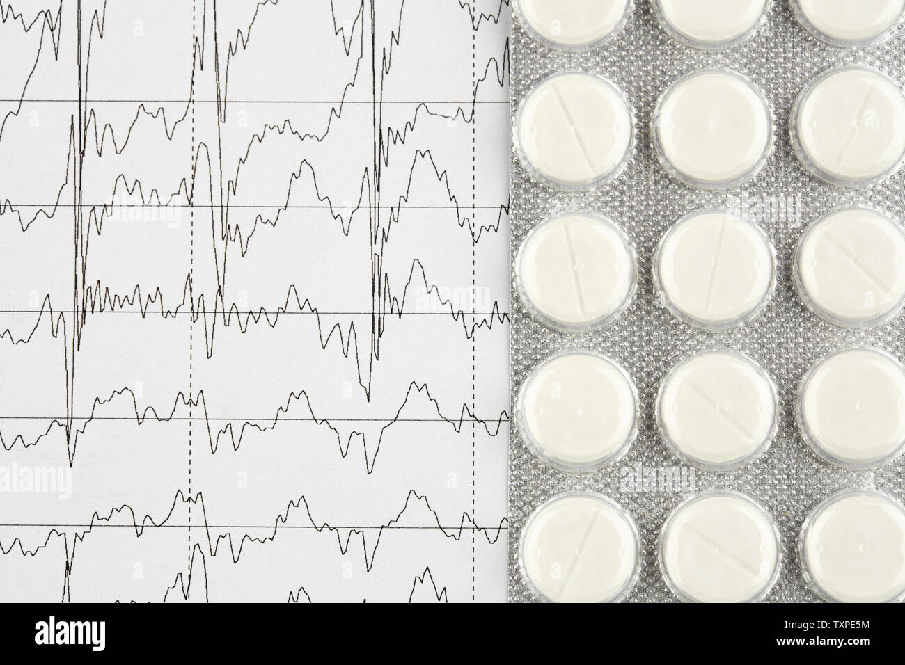 Blister con le pillole di bianco sul grafico EKG. La medicina. Foto Stock