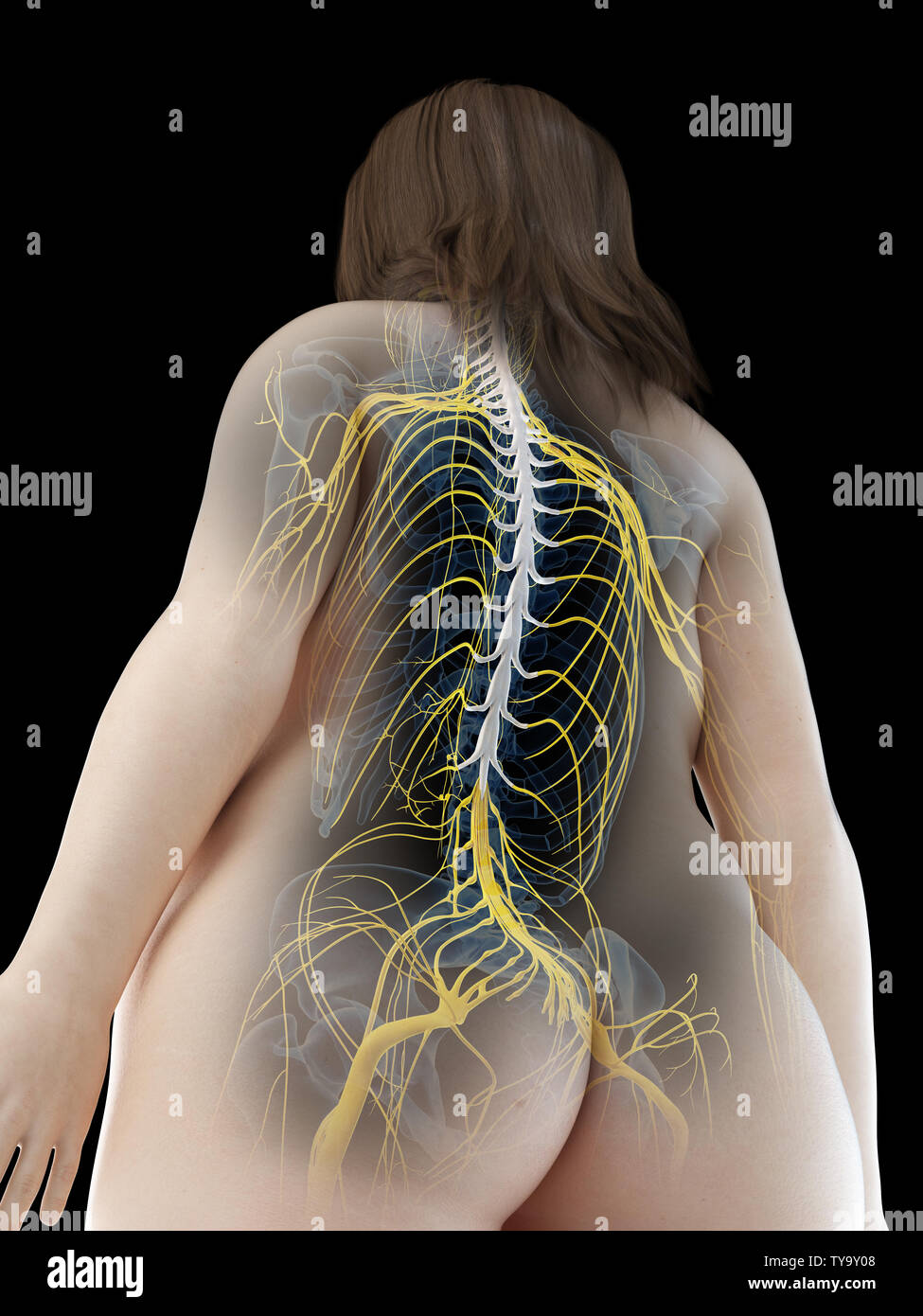 3D Rendering accurato dal punto di vista medico illustrazione di un Femmine obese il midollo spinale Foto Stock
