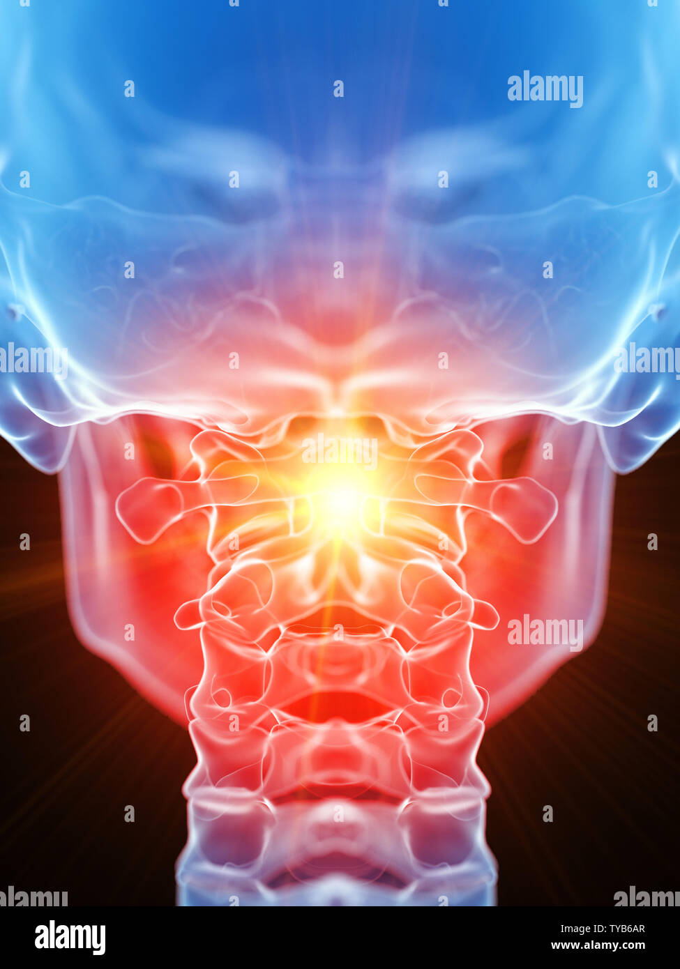 3D Rendering accurato dal punto di vista medico illustrazione della atlas osso mostranti dolore Foto Stock