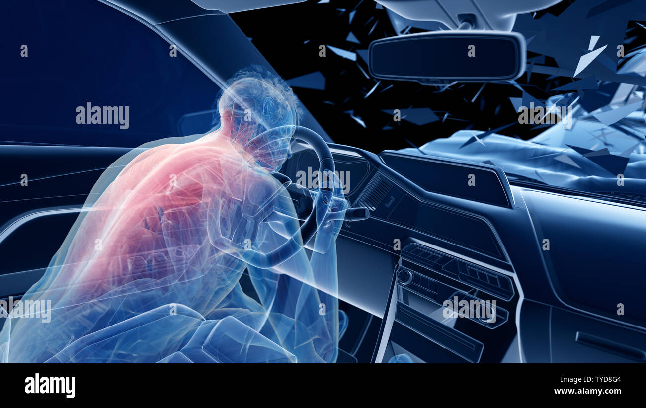 3d reso illustrazione di due collidere cars - che illustra l'effetto di un urto senza airbag Foto Stock