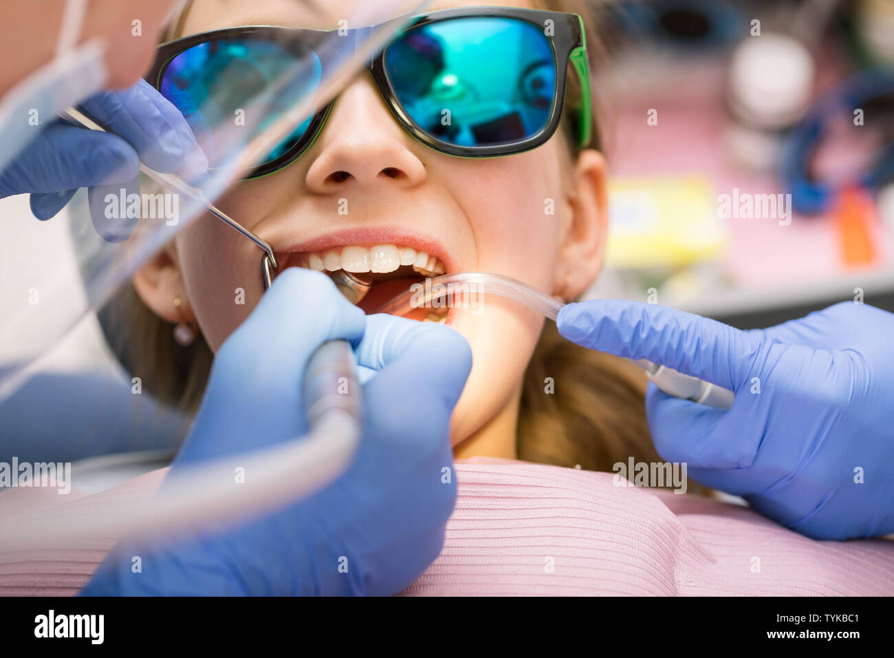 Dentista dentale di eseguire la procedura di rifornimento per preteen girl in pazienti pediatrici clinica dentale. Medico rimozione carie utilizzando ad alta velocità trapano dentale. Bambino è Foto Stock