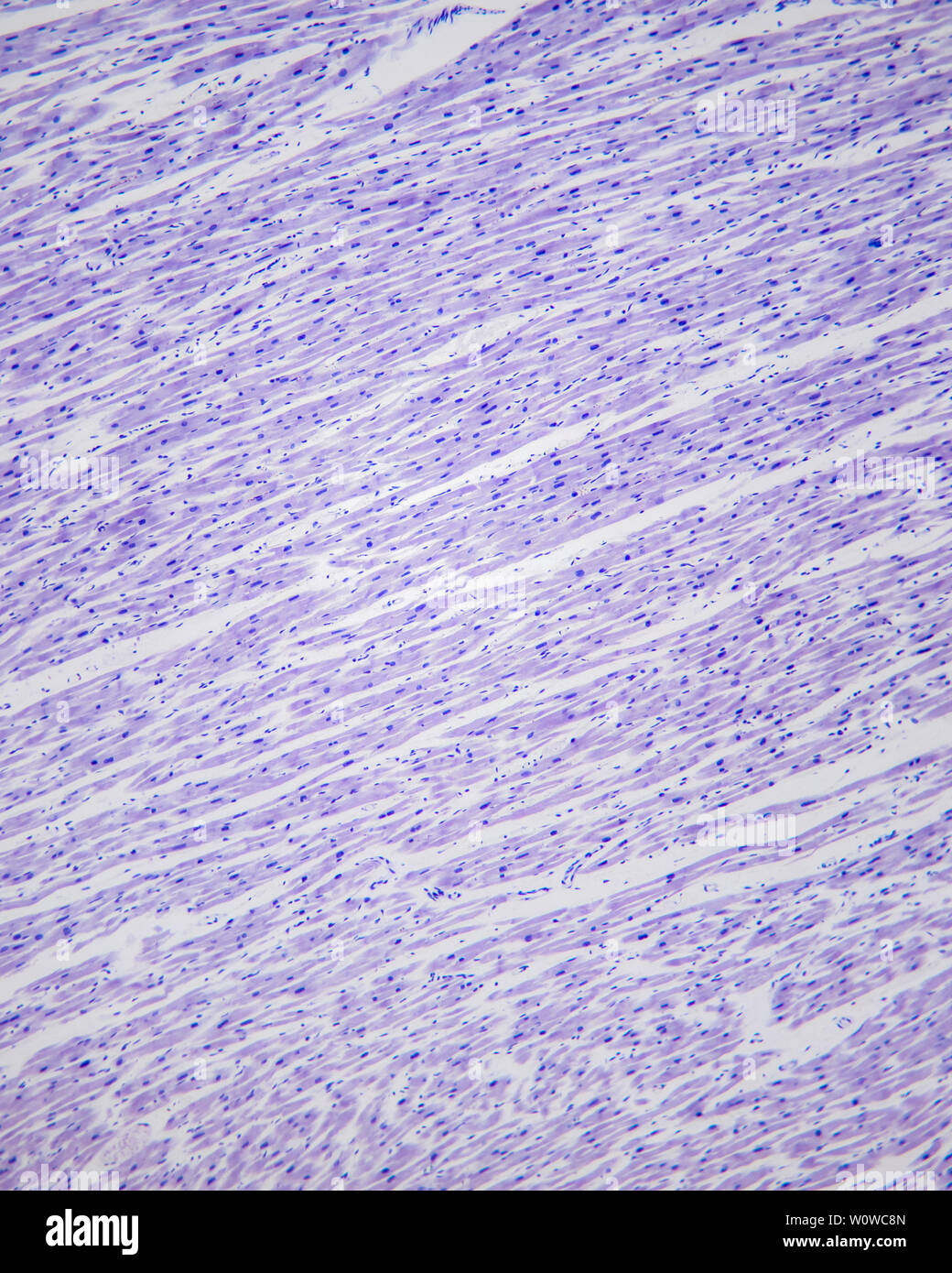 Cymbidium - fibroblasti e fibroblasti dopo 100 ingrandimento x mediante microscopio ottico Foto Stock