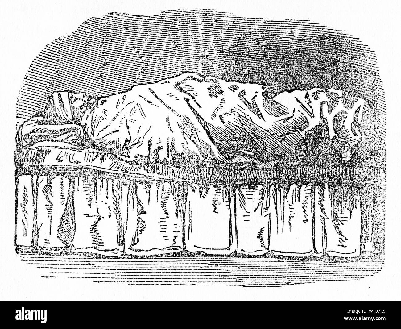 Incisione di una persona utilizzando il foglio umido pack o la busta per un trattamento medico. Da John Smedley di idropatia pratico, circa 1880 Foto Stock
