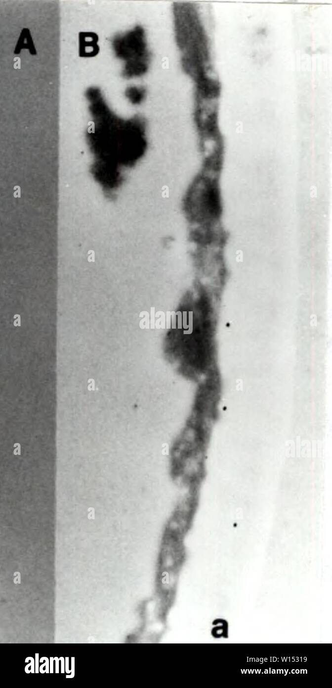 Immagine di archivio da pagina 107 di sviluppo dei metodi cytochemical per l. Sviluppo di metodi cytochemical per lo studio della parete ascospore biogenesis e maturazione . developmentofcyt00lusk Anno: 1991 knA' io la figura 5.1. WGA etichettatura su A. sphaerospora. A) test di WGA; B) buffer di controllo negativo. '' !VS Foto Stock