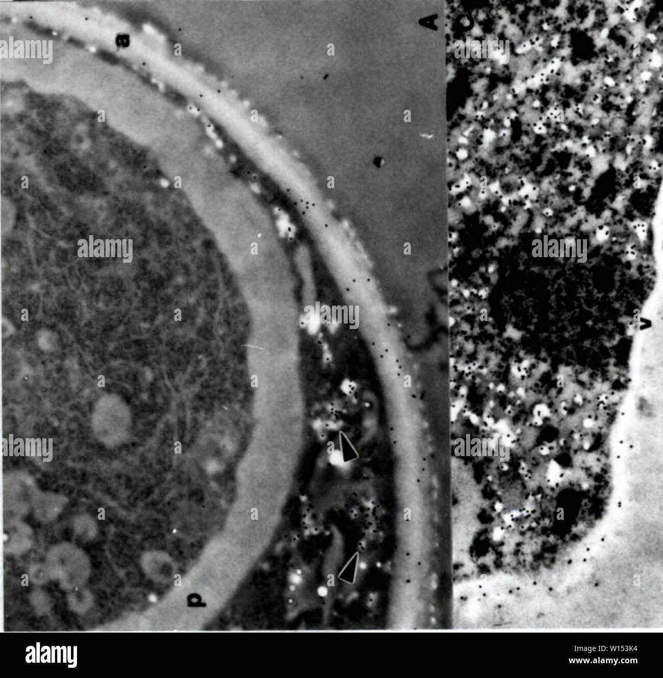 Immagine di archivio da pagina 109 di sviluppo dei metodi cytochemical per l. Sviluppo di metodi cytochemical per lo studio della parete ascospore biogenesis e maturazione . developmentofcyt00lusk Anno: 1991 Foto Stock