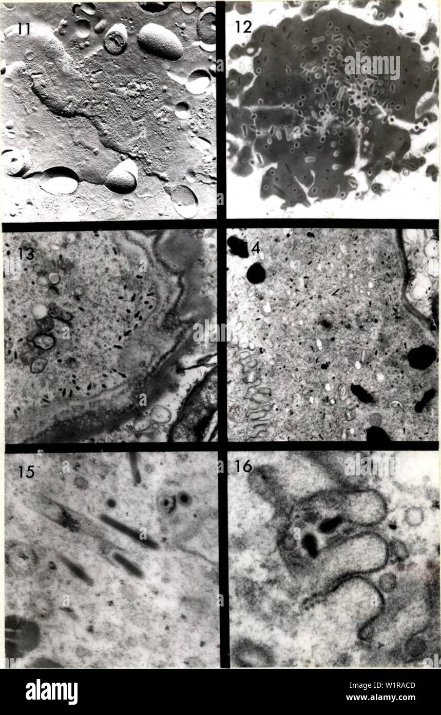 Immagine di archivio da pagina 47 di citopatologia di poliedrosi nucleare. Citopatologia di nuclear polyhedrosis virus in Aedes triseriatus (diciamo) cytopathologyofn00federich Anno: 1970 35 Foto Stock