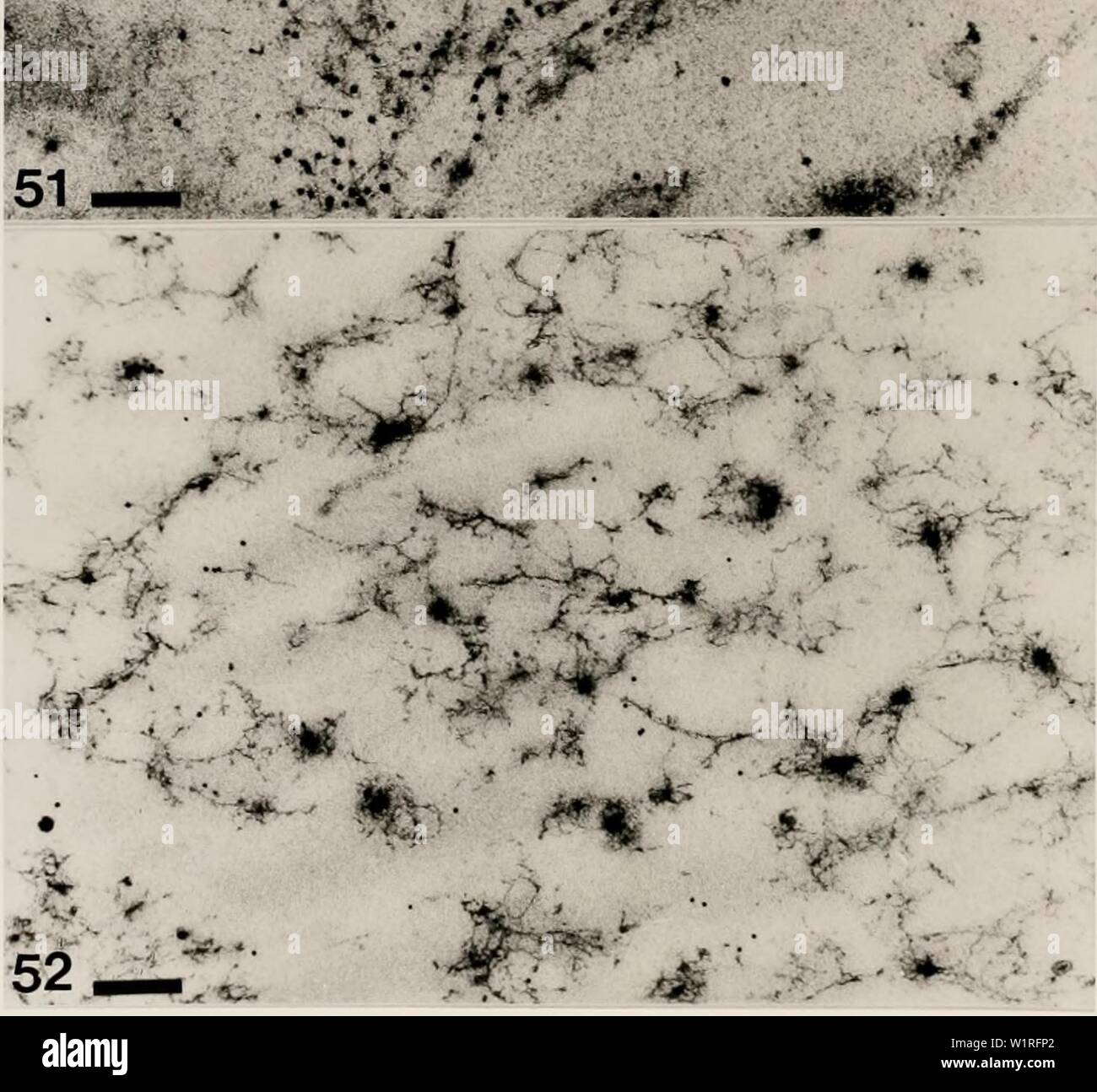 Immagine di archivio da pagina 59 dei metodi citologici per la rivelazione,. Metodi citologici per il rilevamento, l'identificazione e la caratterizzazione del virus di orchidee e i loro corpi di inclusione cytologicalmetho00kona Anno: 1985 -53- " sr &gt; la figura 51. Micrografia elettronica di aggregazioni di virus in CyMV-infettati Cymbidium cella di foglia che mostra la presenza di particelle di oro sulla loro superficie. La sezione viene incubata con antisiero CyMV (1/2000) di diluizione ed etichettati con la proteina A-oro. Bar = 260 nm, figura 52. Micrografia elettronica di virus-simili strutture in stesso antisiero-sezione trattati come in F Foto Stock