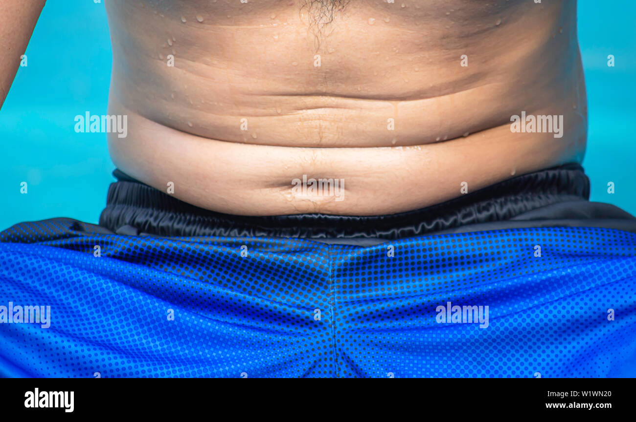 La pelle della pancia di uomini con un eccesso di grasso. Foto Stock