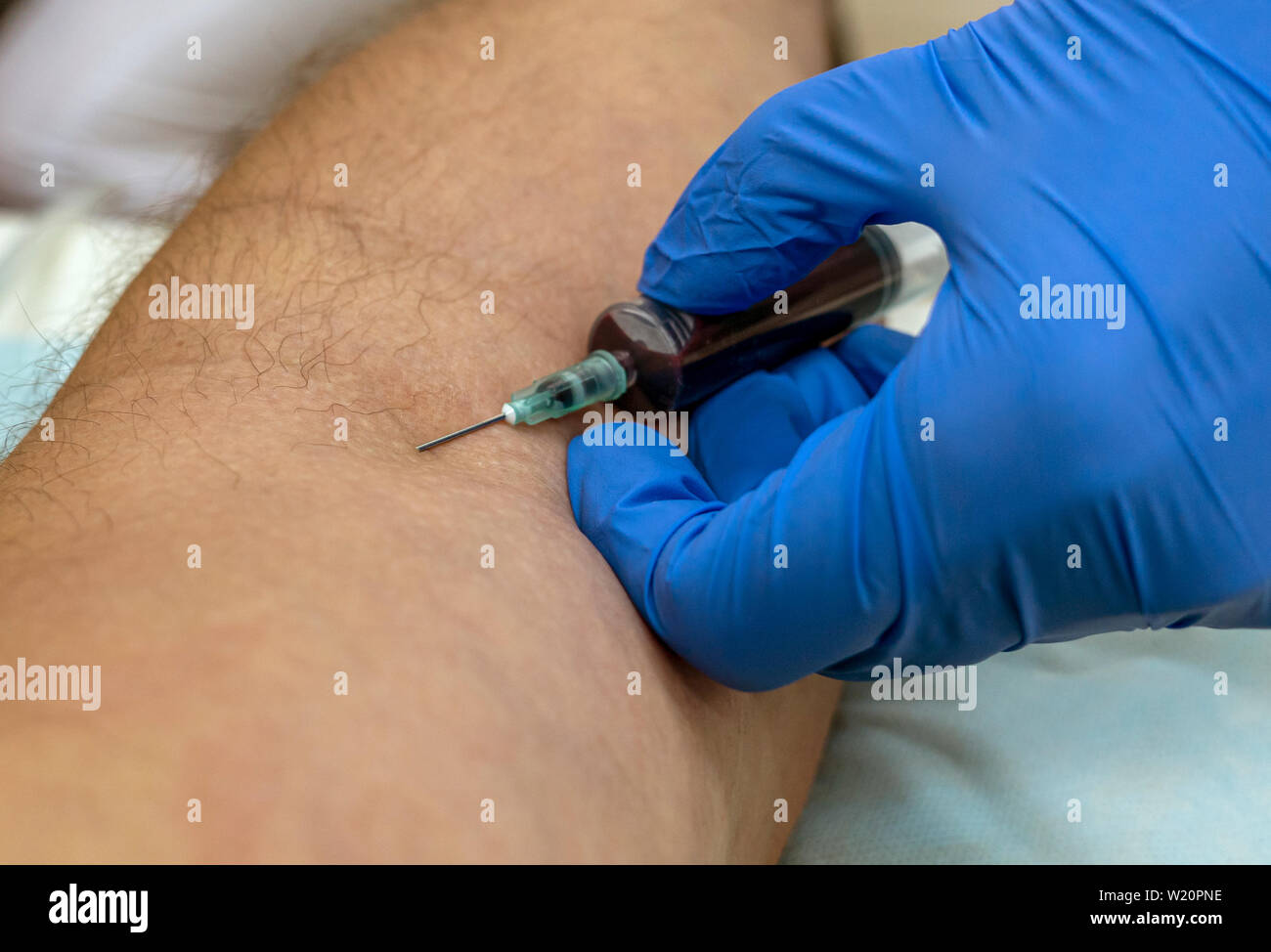 Le mani di un operatore sanitario in guanti blu prendere il sangue dalla vena per le prove Foto Stock