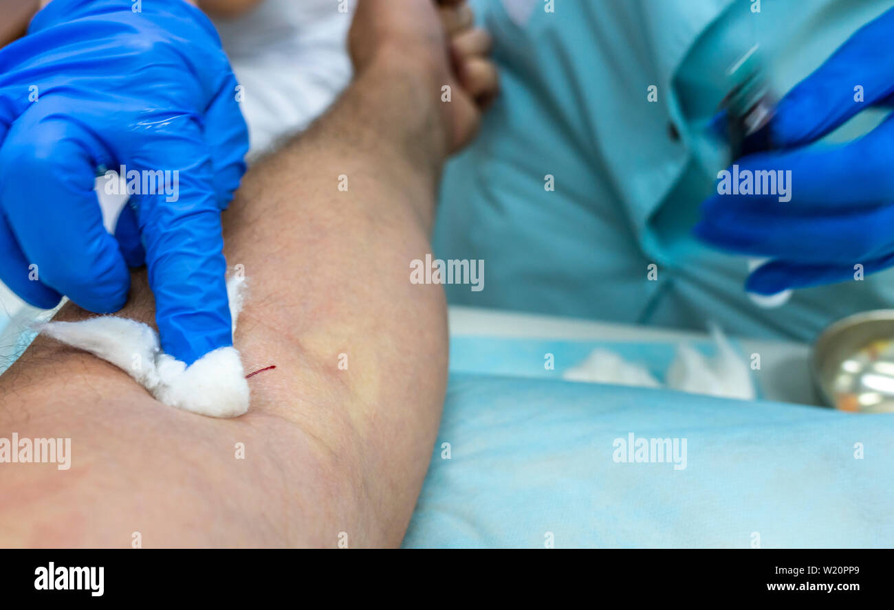 Le mani di un operatore sanitario in guanti blu prendere il sangue dalla vena per le prove Foto Stock