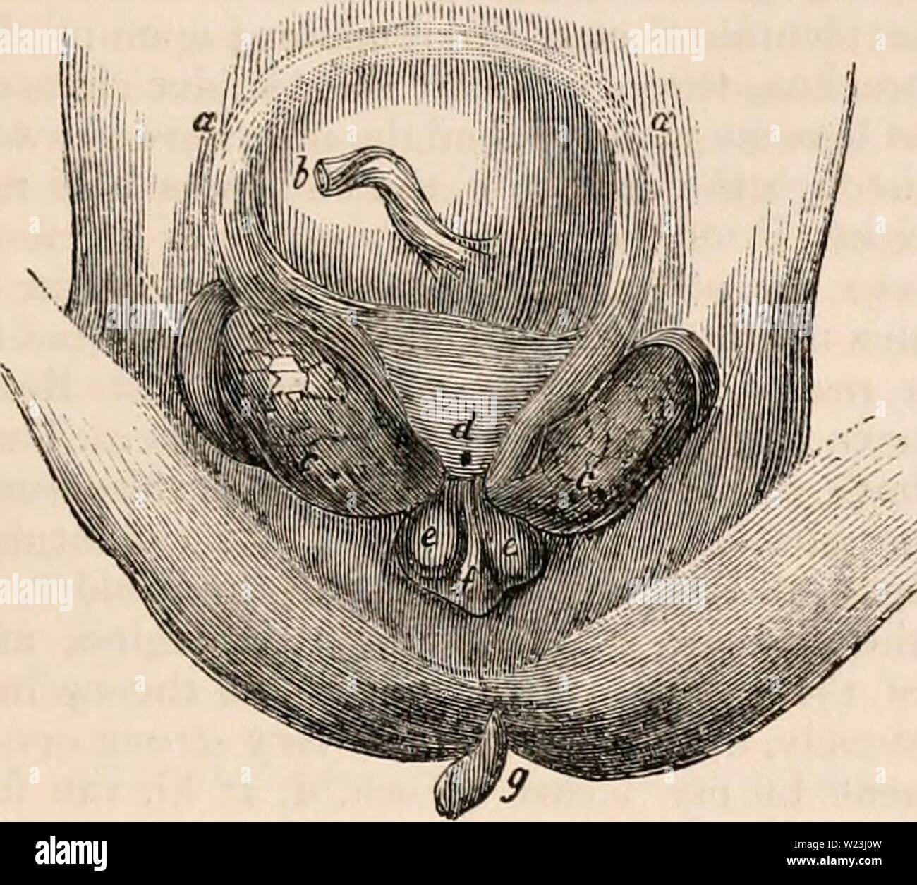 Immagine di archivio da pagina 166 della encyclopaedia - Wikizionario di anatomia e. Il encyclopaedia - Wikizionario di anatomia e fisiologia cyclopdiaofana0402todd Anno: 1849 TERATOLOGIA. 951 con gli organi genitali, proprio come nei casi di ano imperforato appena citato (Meckel, bruciature), o con un ano aperto, come nei casi di Zhryham Oliver, e cofano; questa condi- zione di approcci più vicina alla stato naturale, Fig. 602. Regione Hypogastnc di un bambino, che visse ventidue giorni, con vescica inversa, SFC. a, a, congenite ernia ombelicale; b, cordone ombelicale ; c, c, le due metà separate della vescica urinaria, con ur Foto Stock