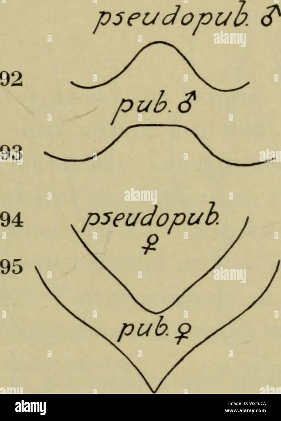 Immagine di archivio da pagina 210 di Danmarks fauna; illustrerede haandbøger oltre. Danmarks fauna; illustrerede haandbøger su den danske dyreverden.. danmarksfaunaill57dans l'anno: 1907 207 tydelig mikronetmaskning, de sidste noget ujaevne. &Lt;J: bagskinnebenene uden spidstorn .. 7. Større, 5-6 mm. &Lt;J: 6. bugleds bagrand med en indskaering, der mi bunden er omtrent ret og lidt fortykket (fig. 93); $: 6. bugled med en spids forlaengelse (fig. 95) 53. pubéscens. Fig. 92-95. Stenus, 6. bugled. Mindre, 4,5-5 mm. £: 6. bugleds bagrand med en rundet indskaering uden fortykkelse (fig. 92); $: 6. bugled Foto Stock