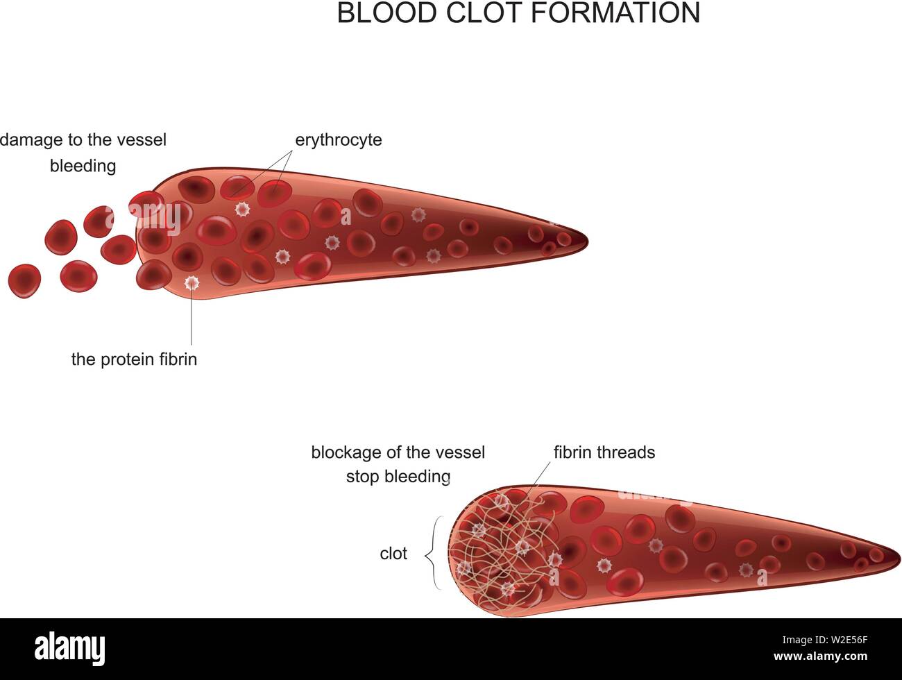 Illustrazione vettoriale della formazione di un coagulo di sangue Illustrazione Vettoriale
