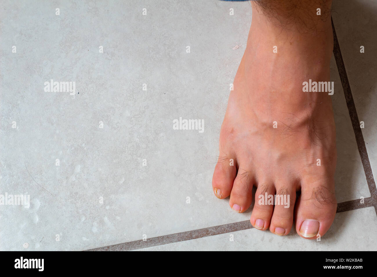 In prossimità dei piedi con una ferita sul dito di piccole dimensioni Foto Stock