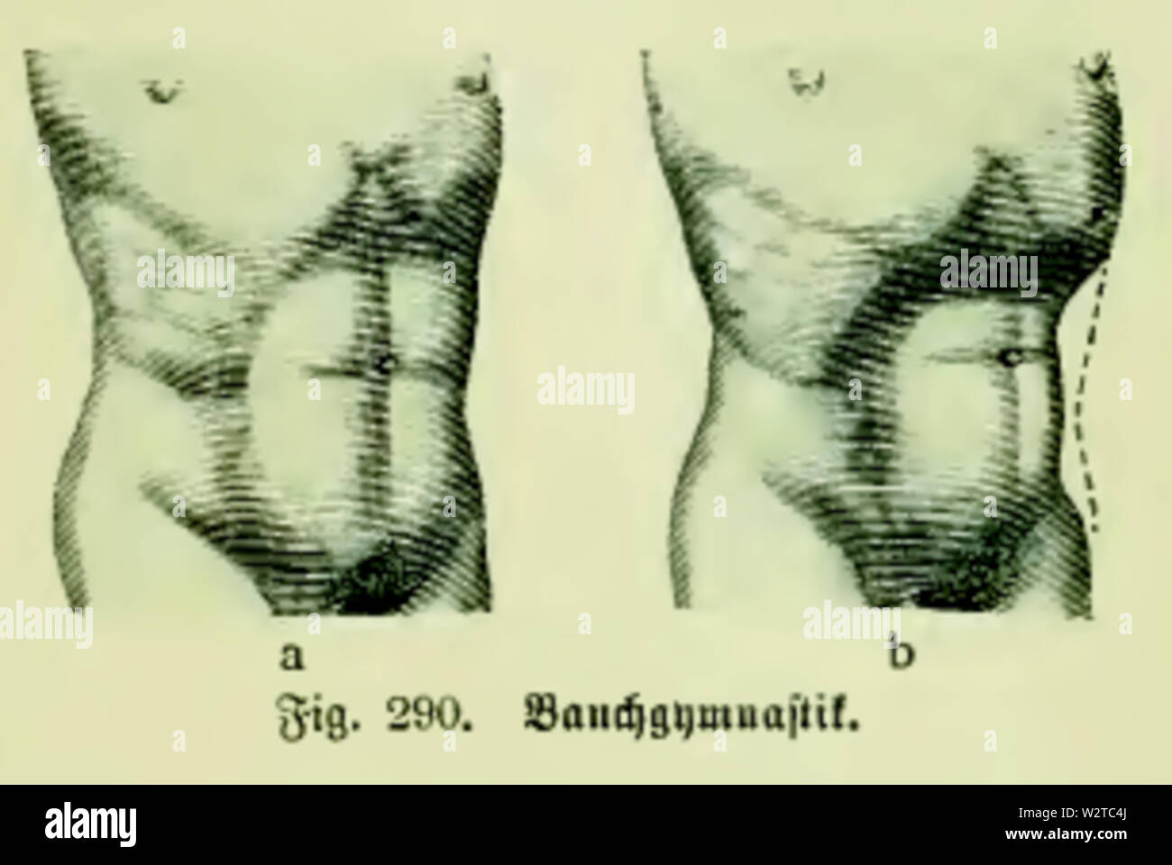 Die Frau als Hausärztin (1911) 290 Bauchgymnastik Foto Stock